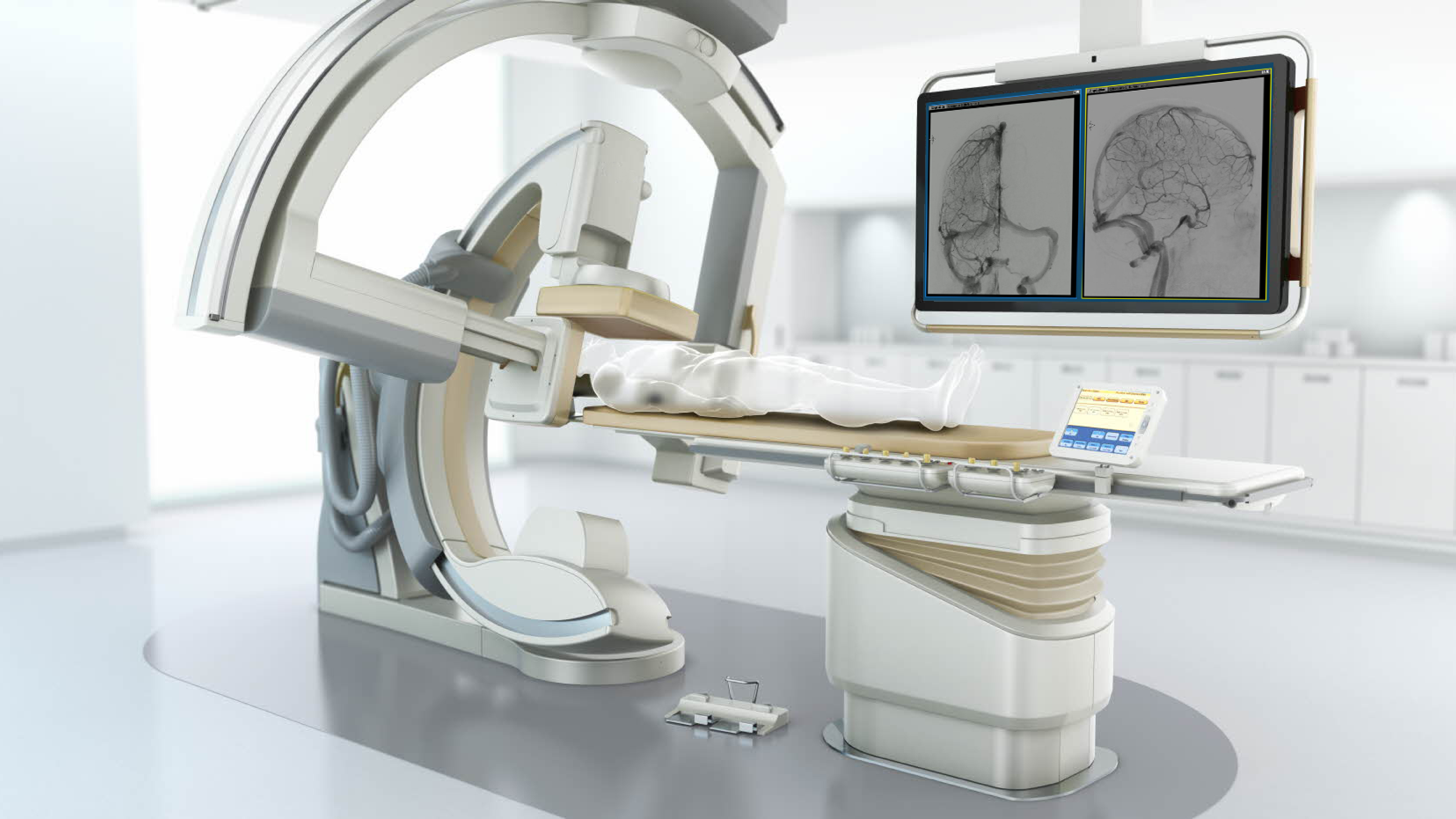 Fluoroscopy system