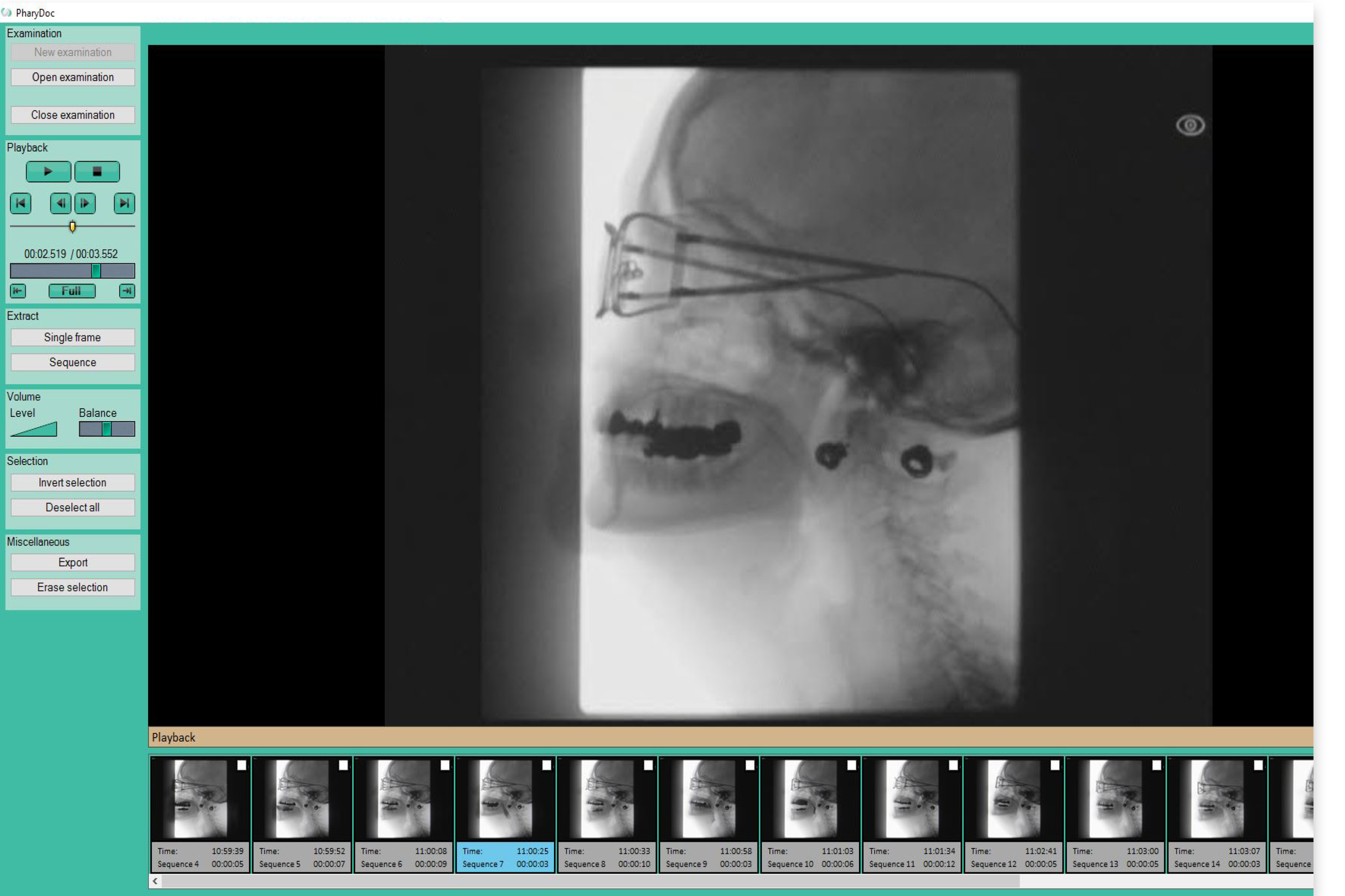 PharyDoc screen capture