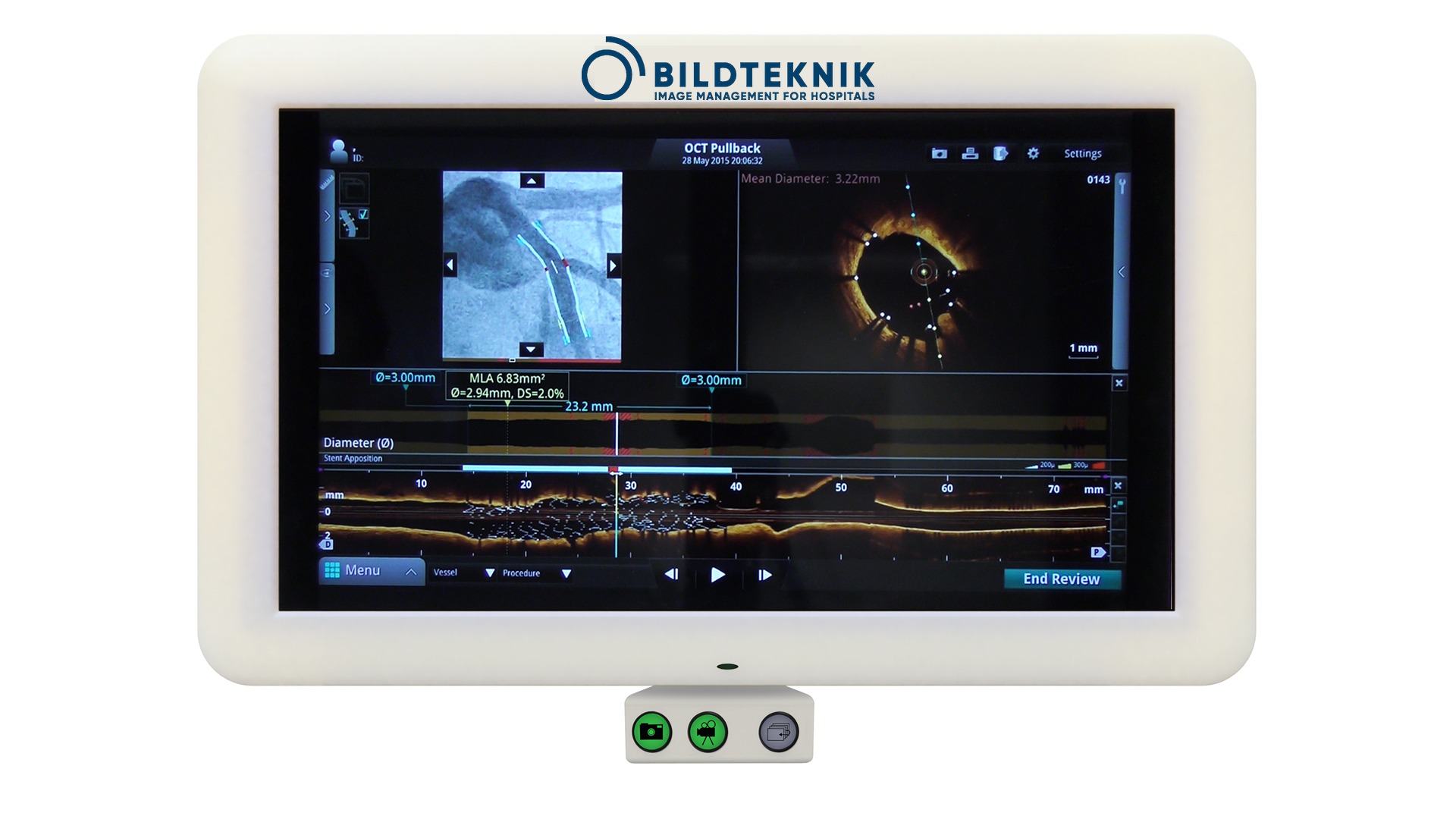 InVision cath lab monitor